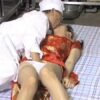 Thumbnail of related posts 120